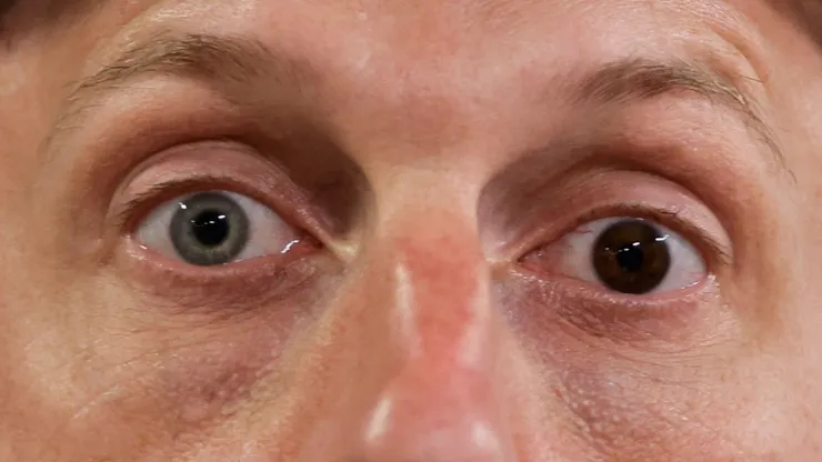 Max Scherzer eyes