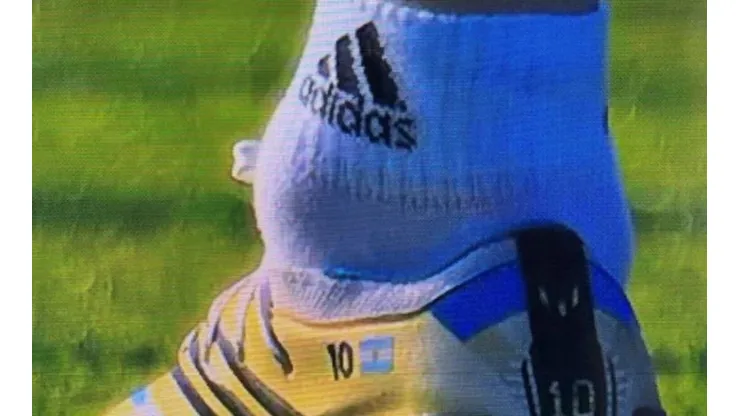 Capture of Lionel Messi's ankle