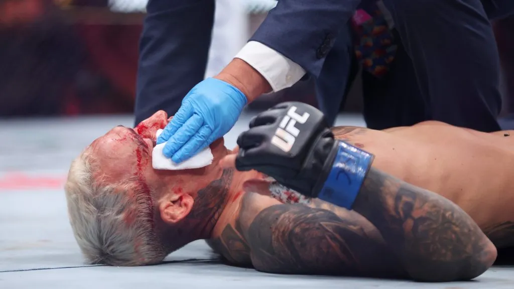 Charles Oliveira got viciously knocked out at UFC 317