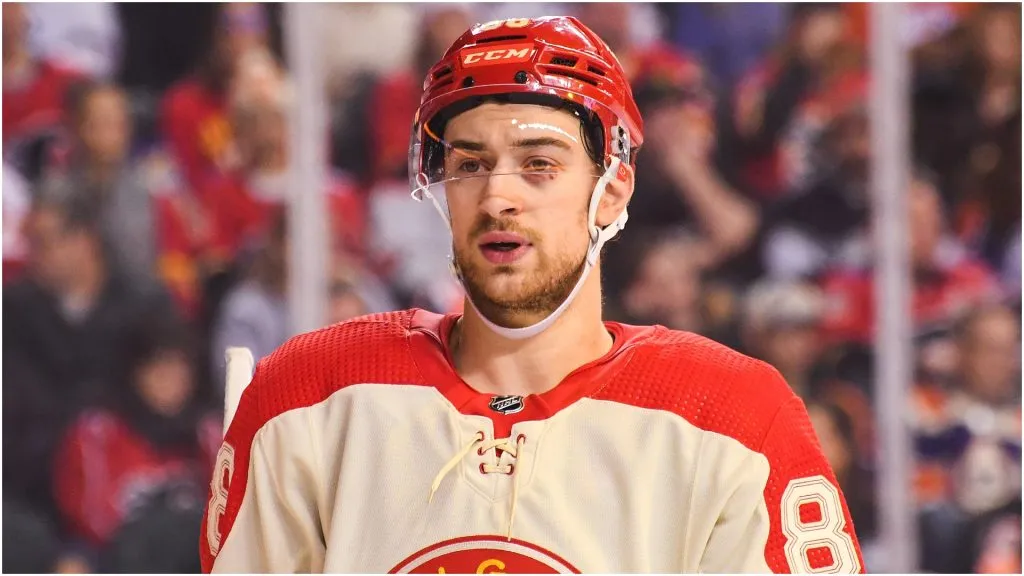 Andrew Mangiapane #88 of the Calgary Flames sports a black eye during the first period of an NHL game against the Edmonton Oilers at Scotiabank Saddledome on January 20, 2024 in Calgary, Alberta, Canada.