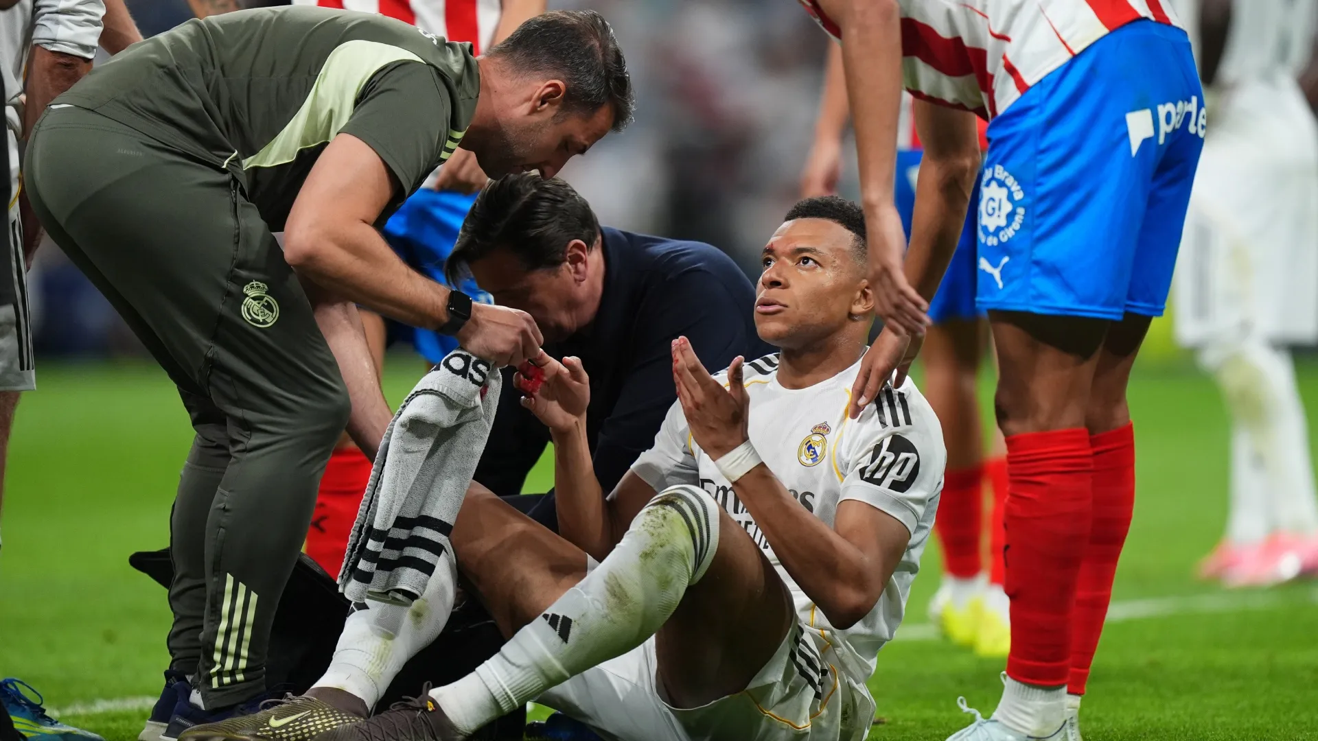 Kylian Mbappe after injuring his face vs Girona