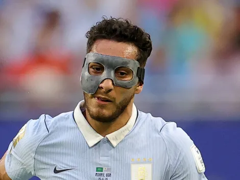 Why World Cup soccer players wear custom protective face masks during games