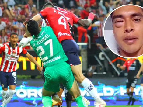 Así quedó el rostro del Tala Rangel tras su lesión ante Atlas