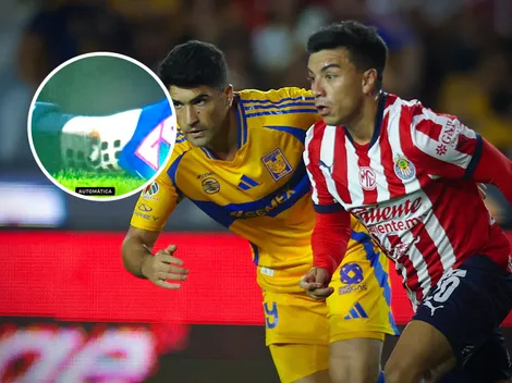 Así quedó la pierna del Nene Beltrán tras el planchazo de Aquino en Chivas vs. Tigres