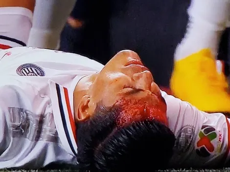 "¿18 minutos y ya voy a salir? ¡No!": "Chapito" habló del corte en su frente