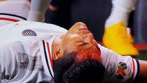 El defensor rojiblanco recibió un corte en su frente que le obligó a jugar con una venda en Tijuana