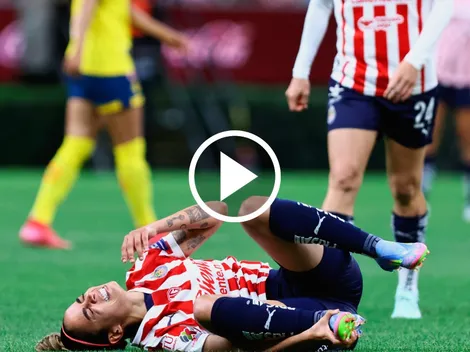 En América pudieron lesionar a Caro Jaramillo