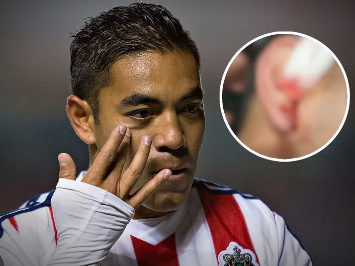 La aparatosa lesión de Marco Fabián en la talacha en Estados Unidos