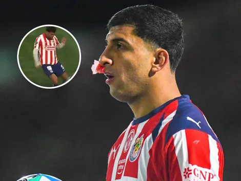 El momento exacto en el que se lesionó el Cotorro González