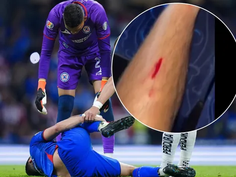 Así le quedó la pierna a Erik Lira tras el planchazo que recibió