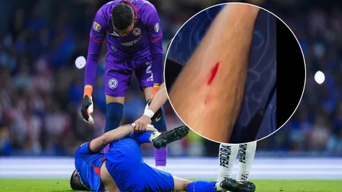 Así le quedó la pierna a Erik Lira tras el planchazo que recibió