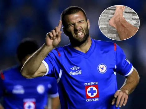 ¡Escalofriante! Así le quedó el pie a "Tito" Villa tras un partido