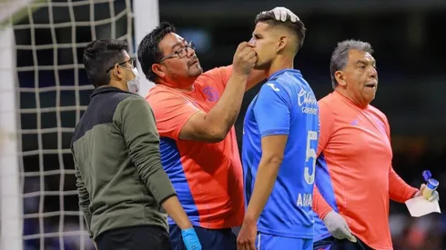 El defensor peruano sufrió fractura de tabique