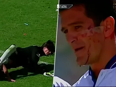 "Esto significa ser Campeón": Carlos Hermosillo mostró su cicatriz del 97