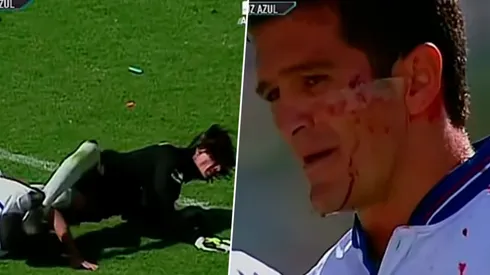 Carlos Hermosillo recibió una brutal patada en la cara en la Final del Invierno de 1997.