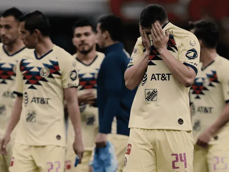 ¡Claro que al América le duele perder con Cruz Azul!