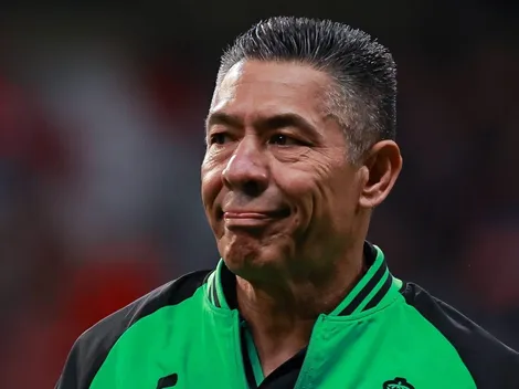 DT de Santos confirmó los peores temores con Cruz Azul