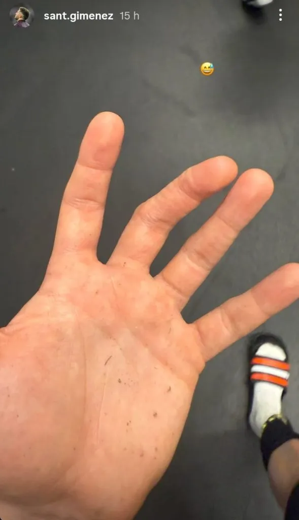 La impresionable lesión de Santi Giménez. (@sant.gimenez)