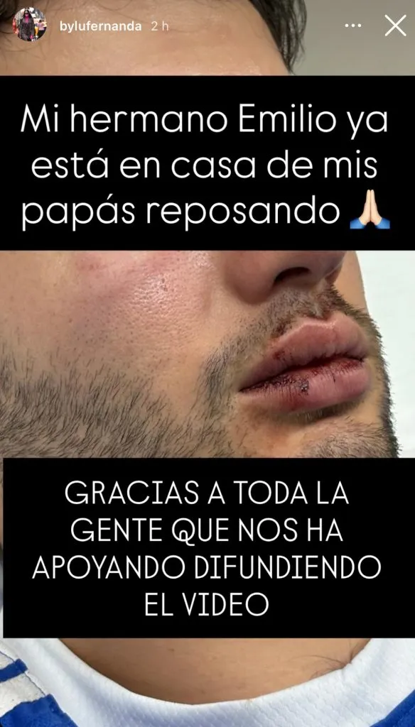 El aficionado de Cruz Azul golpeado en el Akron ya se encuentra en casa. (@bylufernanda)