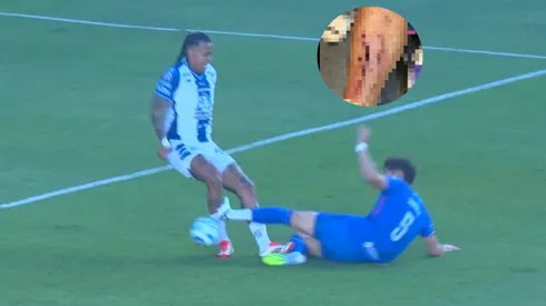 El defensor de Cruz Azul fue expulsado tras una dura entrada al venezolano Jhonder Cádiz.