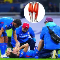 ¿Qué es el gastrocnemio, el músculo que se lesionó Nico Ibáñez?