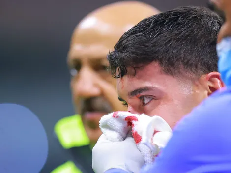 ¿Decisiones arbitrales perjudicaron al América?