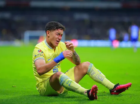 Zendejas cuenta con una fractura en su nariz