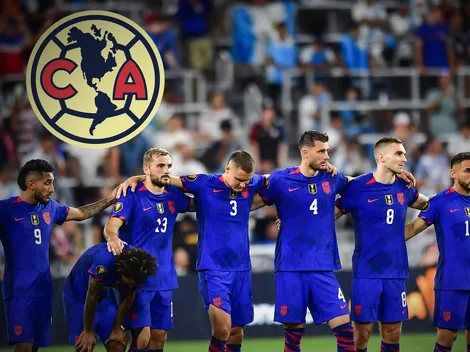 La razón por la que América sufrió la derrota de Estados Unidos