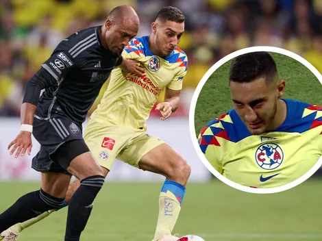 La impactante fractura de nariz de Sebastián Cáceres