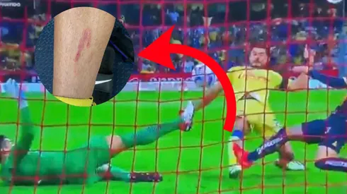 Un recuerdo para la pierna de Henry Martín.