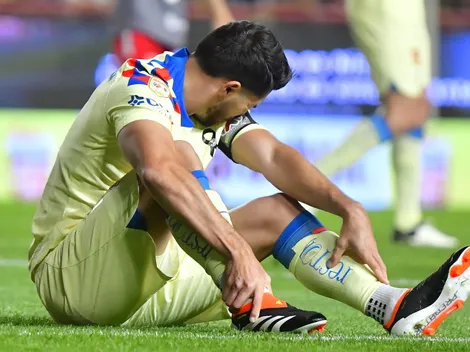 Las tres bajas dolorosas del América para el partido contra Monterrey