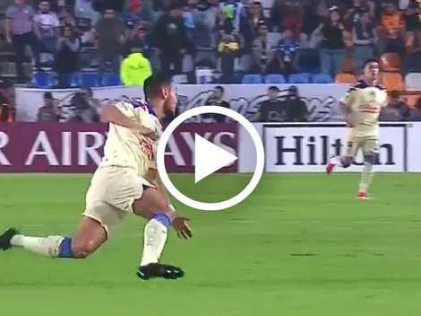 Así fue la terrible lesión de Sebastián Cáceres que lo dejó fuera del América vs Pachuca