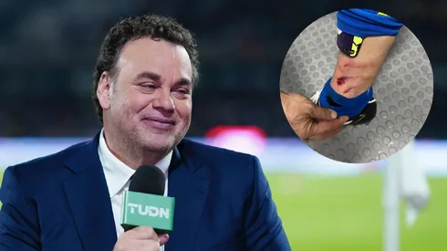 Faitelson se burla de Lichnovsky.