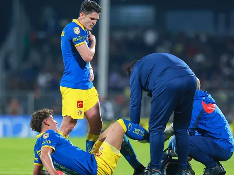 La foto del tobillo de Igor Lichnovsky que indigna al América