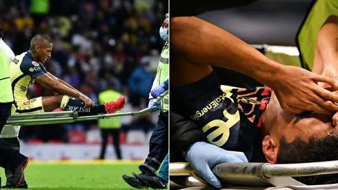 América ha padecido lesiones de todos sus contenciones en el torneo.