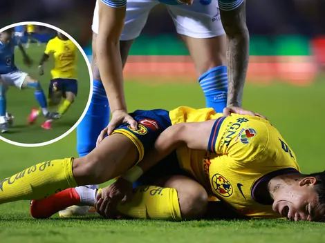 Así quedó la pierna de Kevin Álvarez tras la terrible entrada de Rotondi