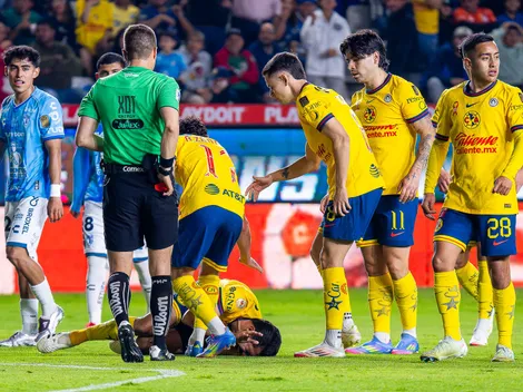 El jugador que el América extrañó más contra Pachuca