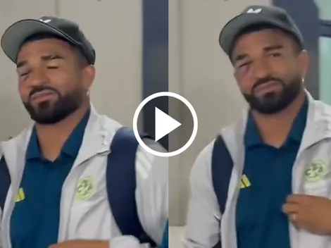 La dura imagen de Rodrigo Aguirre que alarmó a todo América