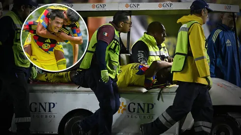 América tiene problemas en su delantera