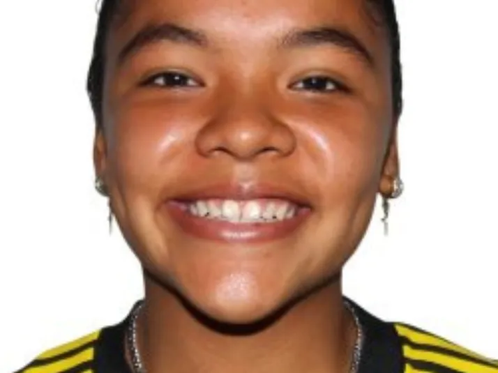 El saldo positivo de América Femenil tras su paso por el Golden Clash