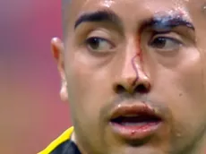 Lo que no viste en TV: El rostro ensangrentado de Erick Sánchez