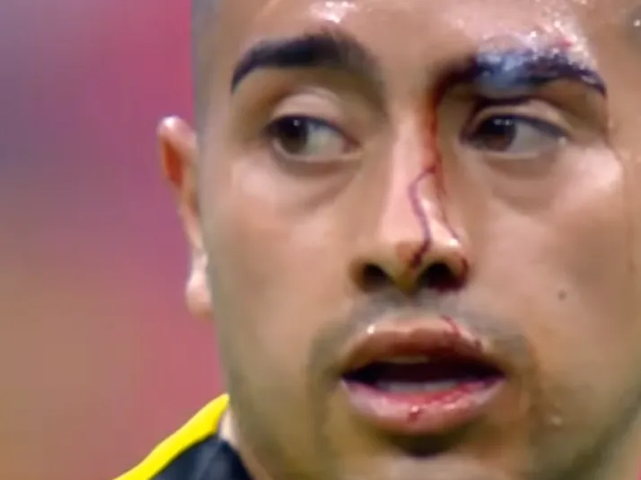 Lo que no viste en TV: El rostro ensangrentado de Erick Sánchez