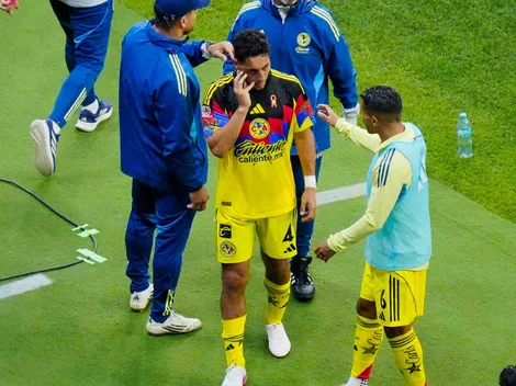 Sebastián Cáceres usaría máscara especial para poder jugar en el Pumas vs América
