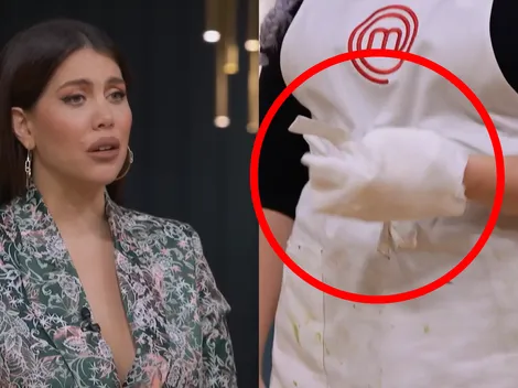 Una participante se quemó la mano y tuvo que ser atendida