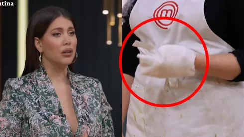 Una participante se quemó la mano y tuvo que ser atendida