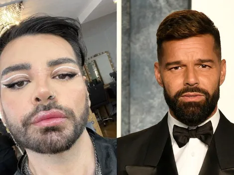 Más de 30 cirugías para parecerse a Ricky Martin: las consecuencias