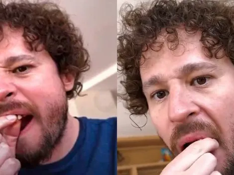 ¿ES REAL? Luisito Comunica pierde dos dientes en una transmisión EN VIVO