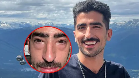 Jezzini preocupó a sus fans por su apariencia