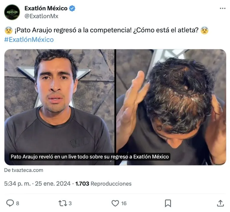 Así luce actualmente la dolorosa herida de Pato Araujo. Imagen: X.