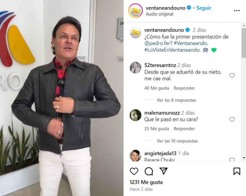 Así es como luce el rostro de Pedro Fernández en la actualidad. Imagen: @ventaneandouno.